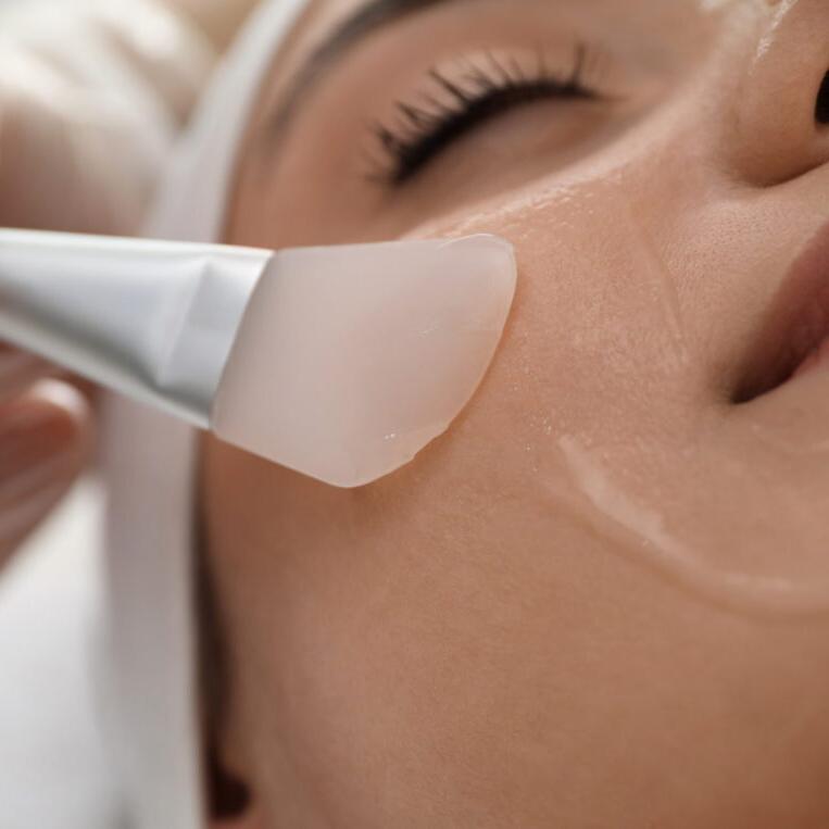 Chemical peel being applied to skin