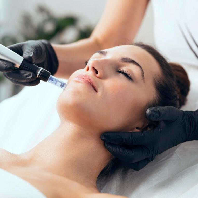 Microneedling treatments in Lewis Center